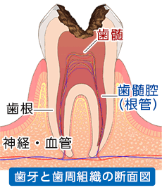 歯牙と歯周組織の断面図