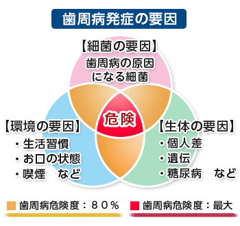 歯周病の発症要因