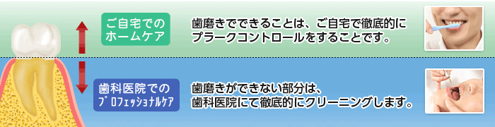 口腔ケアのための予防歯科